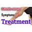 Muscle Cramps  Treatment And Symptoms My Health Care