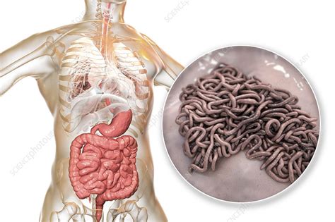 Round Worms In Human Intestine Illustration Stock Image F032 6001 Science Photo Library