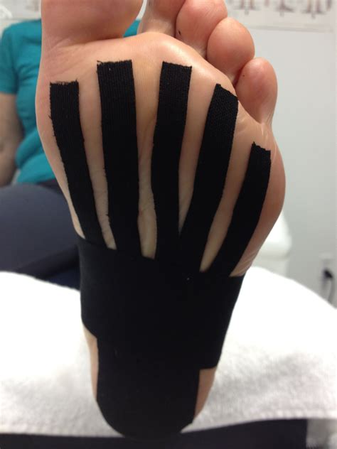 Did You Know That Kinesio Taping Is Helpful In The Healing Process Of
