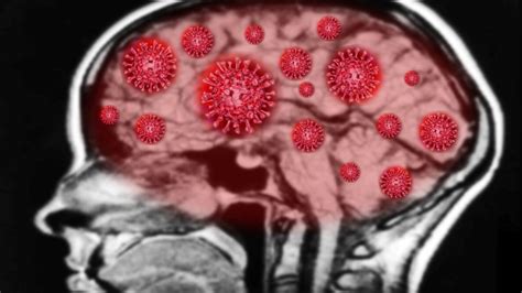 How Coronavirus Affects The Brain And Central Nervous System 7news