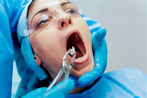 Tooth Extraction The Process Of Tooth Removal Best Dentist In Toronto