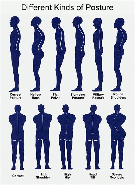 Posture Fix Posture Exercises Bad Posture Better Posture Poor