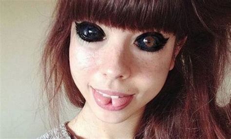 Woman Loses Her Sight After Getting Eyeballs Tattooed Black