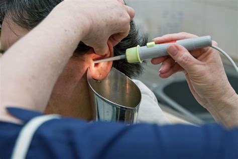Ear Wax Removal Photograph By Life In Viewscience Photo Library