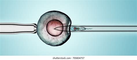 Artificial Insemination By Intracytoplasmic Sperm Injection Stock Illustration