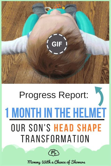 Fixing Our Sons Flat Head With A Cranial Helmet Baby Month By Month
