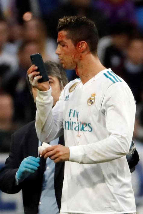 I'm sergio ramos garcía, captain of real madrid and a spanish national team player. Cristiano Ronaldo, sangue in faccia dopo un calcio: si ...