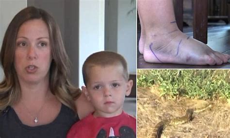 Pregnant Us Mother Risks Her Life By Sucking Rattlesnake Venom From Son