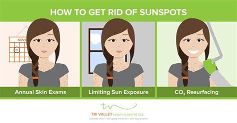 How To Get Rid Of Sunspots Tri Valley Livewell