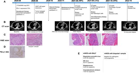 Frontiers Case Report Spontaneous Remission In Lung Carcinoma With A