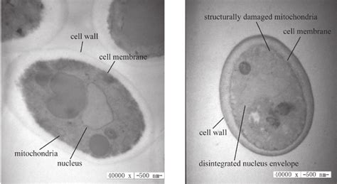 Transmission Electron Microscopy Micrographs Of Candida Krusei Cells