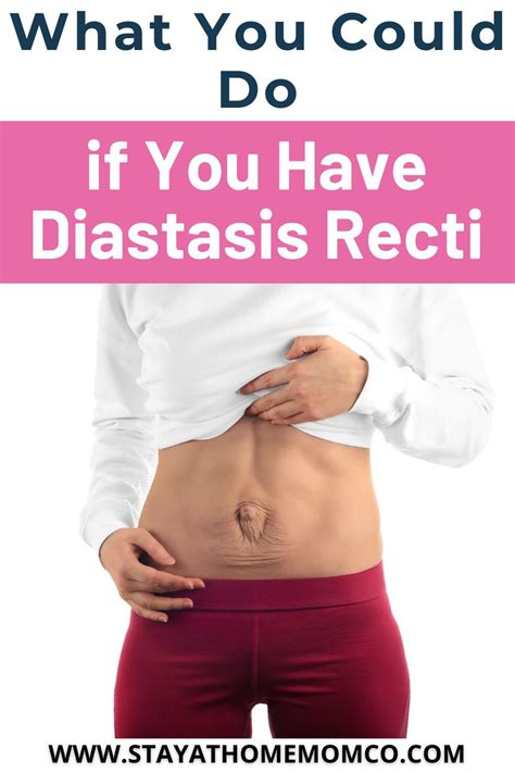 Diastasis Recti Repair To Fix Separated Abdominal Muscles Diastasis