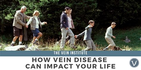 How Vein Disease Can Impact Your Life The Vein Institute At Ssa