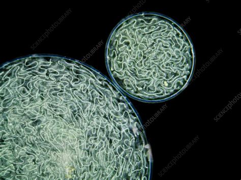 Nostoc Cyanobacteria Light Micrograph Stock Image C0125196