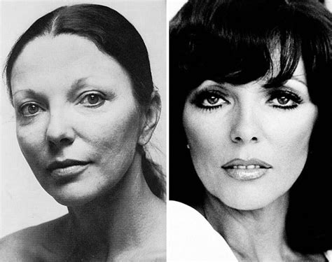 Joan Collins Before And After Plastic Surgery