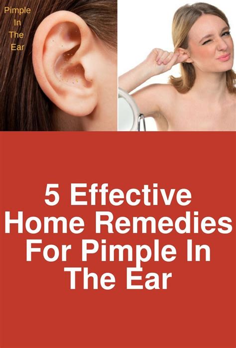 5 effective home remedies for pimple in the ear
