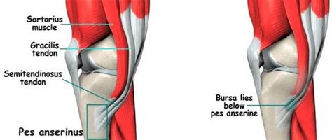 Pes Anserinus - 2 | Sartorius muscle, Wind sock, Anatomy