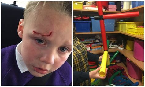 Boy Banned From Playgroup After Mum Complained About Accident That Left Him Scarred For Life