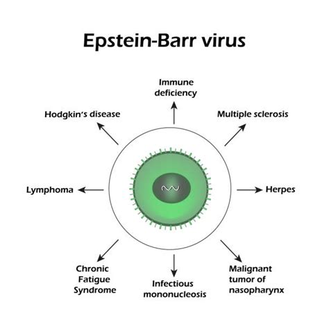 Epstein Barr Virusillustrationer Och Vektorbilder Istock