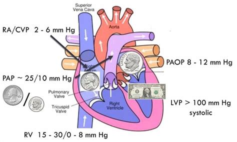 A Quick And Easy Way To Remember Normal Intracardiac Pressures Called