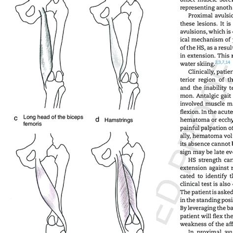 Schematic Drawing Of The Hamstrings Download Scientific Diagram