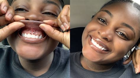 I Pierced My Own Smiley Again At Home Smiley Piercing Upper Lip Frenulum Piercing Youtube