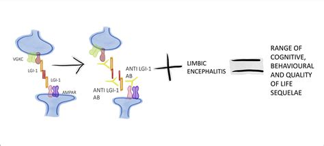 The Neuropsychological Spectrum Of Anti Lgi1 Antibody Mediated