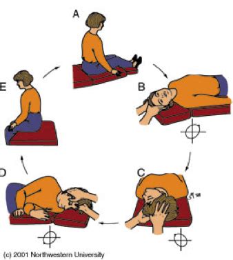 This position uses gravitational forces to. Benign Paroxymal Positional Vertigo Sydney | BPPV ...