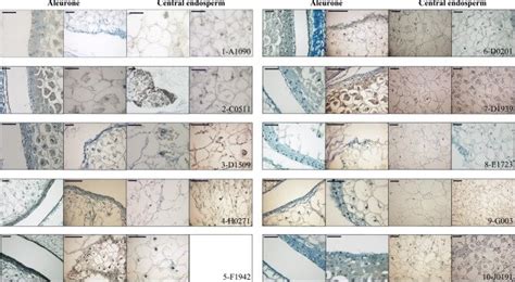Aleurone And Central Endosperm Structure Sections Of Wt First And