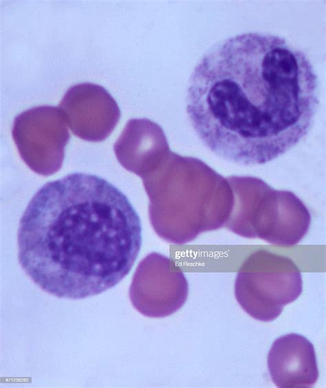 Early Developmental Stages Of White Blood Cells In Human Bone Marrow