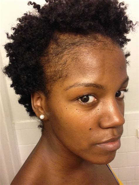 I'm assuming your usual grooming helps a little in those not completely. Natural Hair | Thinning Edges | How to Grow Edges and Bald Spots | Thin natural hair, Hair ...