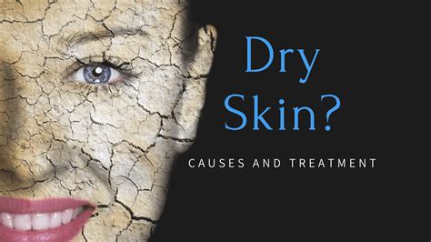 The Common Causes Of Dry Skin And How To Treat It