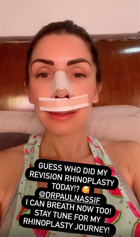 Botched S Dr Paul Nassif Gives His Own Wife Brittany A Nose Job And She Shares Gruesome Post