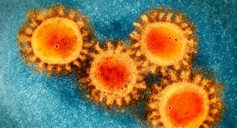 It is part of a family of viruses called coronaviruses that infect both animals and people. The COVID-19 coronavirus epidemic has a natural origin ...