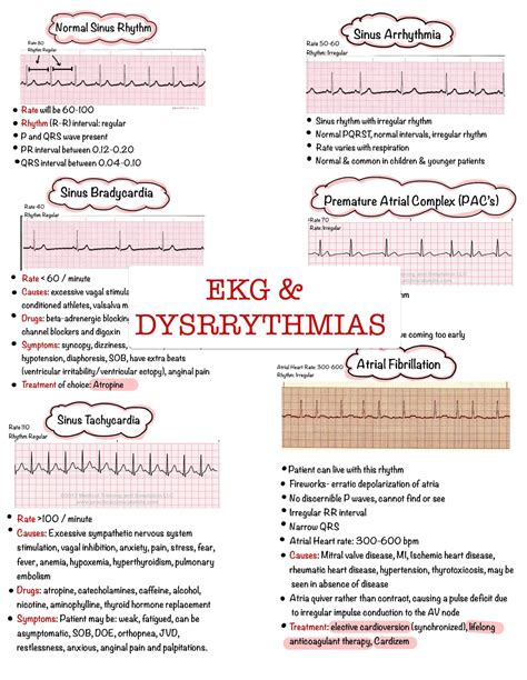 Basic Ekg Dysrhythmias And Interpretation Nursing Notes 6 Pages Digital