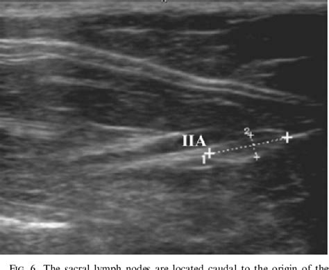 Pdf Ultrasonographic Anatomy Of Abdominal Lymph Nodes In The Normal