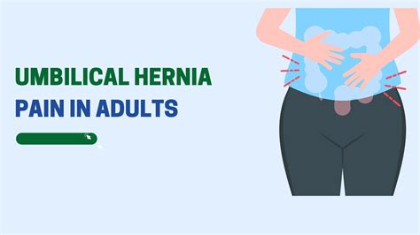 Umbilical Hernia Pain In Adults A Detailed Explanation