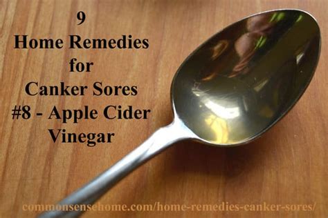 9 Home Remedies For Canker Sores And Tips To Avoid Canker