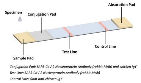Covid 19 Antigen Rapid Test Kit Joysbio Biotechnology