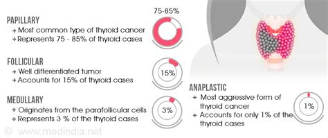 Thyroid Cancer Types Spread