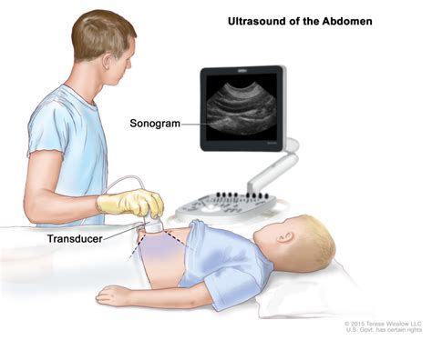 Figure Abdominal Ultrasound An Ultrasound Transducer Pdq