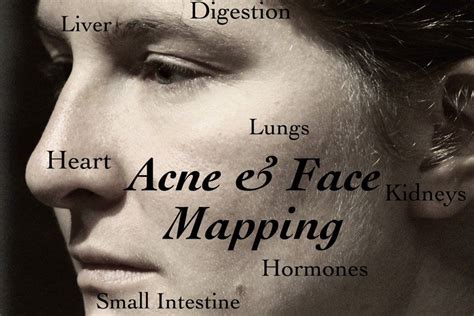 Face Mapping Helps Us Understand How Internal Factors Cause Acne