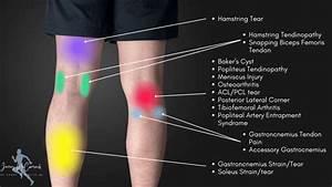 Knee Location Chart Learn The Location Of Knee Injuries