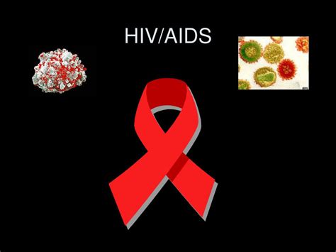 ppt hiv aids powerpoint presentation free download id 5901564