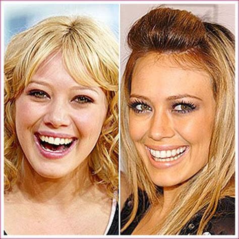 Scary Celebrity Plastic Surgery Before And After Hilary Duff Babe And And Natural