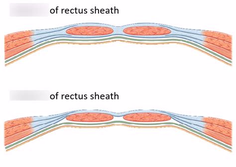 Rectus Sheath Anatomy Diagram Quizlet