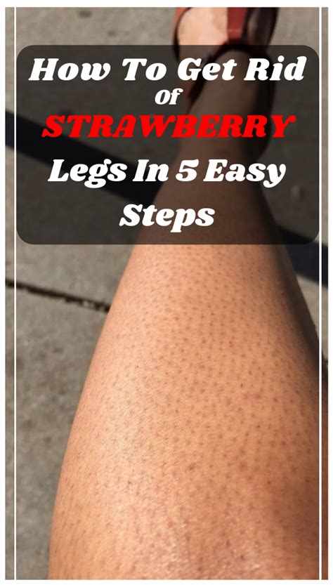 How To Get Rid Of Strawberry Legs In 5 Easy Steps Healthy Score
