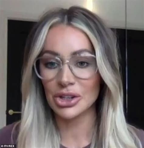 Love Island S Olivia Attwood Discusses Living With Adhd Sound Health
