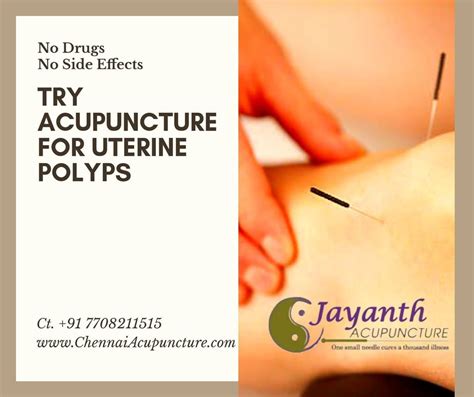 Menstrual Disorders Treatment Service at Rs session acupressure massage एकयपकचर