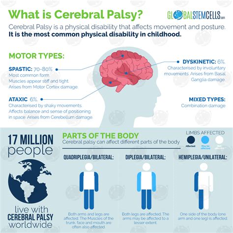 Cerebral Palsy Treatment